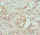 COG5 Antibody - Immunohistochemistry of paraffin-embedded human pancreatic cancer at dilution 1:100