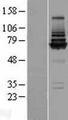 COG8 Protein - Western validation with an anti-DDK antibody * L: Control HEK293 lysate R: Over-expression lysate