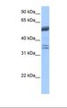 COIL / Coilin Antibody - Jurkat cell lysate. Antibody concentration: 1.0 ug/ml. Gel concentration: 12%.  This image was taken for the unconjugated form of this product. Other forms have not been tested.