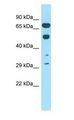 COIL / Coilin Antibody - COIL / Coilin antibody Western Blot [Target Name] antibody. Sample Tissue:Rat Testis lysates. Antibody Dilution: 1.0 ug/ml.  This image was taken for the unconjugated form of this product. Other forms have not been tested.
