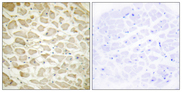 COL14A1 / Collagen XIV Antibody - Immunohistochemistry analysis of paraffin-embedded human heart tissue, using Collagen XIV alpha1 Antibody. The picture on the right is blocked with the synthesized peptide.