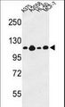 COL17A1 / Collagen XVII Antibody - Western blot of COL17A1 Antibody in A375, A2058, HL-60, MCF-7 cell line lysates (35 ug/lane). COL17A1 (arrow) was detected using the purified antibody.