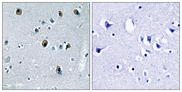 COL20A1 / Collagen XX Antibody - Immunohistochemistry analysis of paraffin-embedded human brain tissue, using Collagen XX alpha1 Antibody. The picture on the right is blocked with the synthesized peptide.