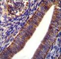 COL21A1 / Collagen XXI Antibody - COL21A1 Antibody immunohistochemistry of formalin-fixed and paraffin-embedded human uterus tissue followed by peroxidase-conjugated secondary antibody and DAB staining.