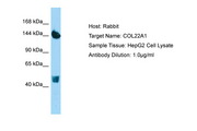 COL22A1 / Collagen XXII Antibody -  This image was taken for the unconjugated form of this product. Other forms have not been tested.