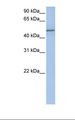 COL25A1 / Collagen XXV Antibody - Jurkat cell lysate. Antibody concentration: 1.0 ug/ml. Gel concentration: 12%.  This image was taken for the unconjugated form of this product. Other forms have not been tested.