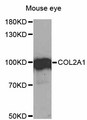 COL2A1 / Collagen II Alpha 1 Antibody - Western blot analysis of extracts of mouse eye, using COL2A1 antibody at 1:1000 dilution. The secondary antibody used was an HRP Goat Anti-Rabbit IgG (H+L) at 1:10000 dilution. Lysates were loaded 25ug per lane and 3% nonfat dry milk in TBST was used for blocking. An ECL Kit was used for detection and the exposure time was 30s.