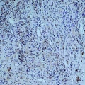 COL3A1 / Collagen III Antibody - Immunohistochemical analysis of Collagen 3 alpha 1 staining in human skin formalin fixed paraffin embedded tissue section. The section was pre-treated using heat mediated antigen retrieval with sodium citrate buffer (pH 6.0). The section was then incubated with the antibody at room temperature and detected using an HRP conjugated compact polymer system. DAB was used as the chromogen. The section was then counterstained with hematoxylin and mounted with DPX.