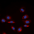 COL4A6 / Collagen IV Antibody - Immunofluorescent analysis of Collagen 4 alpha 6 staining in K562 cells. Formalin-fixed cells were permeabilized with 0.1% Triton X-100 in TBS for 5-10 minutes and blocked with 3% BSA-PBS for 30 minutes at room temperature. Cells were probed with the primary antibody in 3% BSA-PBS and incubated overnight at 4 ??C in a humidified chamber. Cells were washed with PBST and incubated with a DyLight 594-conjugated secondary antibody (red) in PBS at room temperature in the dark. DAPI was used to stain the cell nuclei (blue).