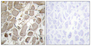 COL5A1 / Collagen V Alpha 1 Antibody - Immunohistochemistry analysis of paraffin-embedded human heart tissue, using Collagen V alpha1 Antibody. The picture on the right is blocked with the synthesized peptide.