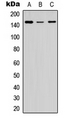 COL5A2 / Collagen V Alpha 2 Antibody - Western blot analysis of Collagen 5 alpha 2 expression in HEK293T (A); Raw264.7 (B); PC12 (C) whole cell lysates.