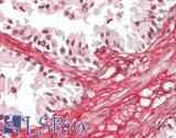COL6A3 / Collagen VI Alpha 3 Antibody - Human Prostate: Formalin-Fixed, Paraffin-Embedded (FFPE)