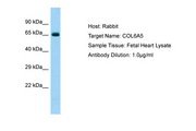 COL6A5 / Collagen VI Antibody -  This image was taken for the unconjugated form of this product. Other forms have not been tested.