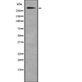 COL7A1 / Collagen VII Antibody - Western blot analysis of Collagen VII a1 using HeLa whole cells lysates