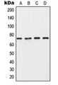COL8A1 / Collagen VIII Alpha 1 Antibody - Western blot analysis of Collagen 8 alpha 1 expression in MDA-MB453 (A); A549 (B); SP2/0 (C); PC12 (D) whole cell lysates.