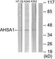 COL9A2 Antibody - Western blot of extracts from HT29 cells, A549 cells and K562 cells, using Collagen IX alpha 2 antibody.