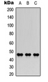COLQ Antibody - Western blot analysis of AChE Q expression in A549 (A); NS-1 (B); H9C2 (C) whole cell lysates.