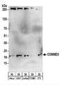 COMMD3 / BUP Antibody - Detection of Human and Mouse COMMD3 by Western Blot. Samples: Whole cell lysate (50 ug) from HeLa, 293T, Jurkat, mouse TCMK-1, and mouse NIH3T3 cells. Antibodies: Affinity purified rabbit anti-COMMD3 antibody used for WB at 1 ug/ml. Detection: Chemiluminescence with an exposure time of 3 minutes.