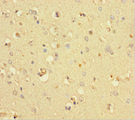 COMMD6 Antibody - Immunohistochemistry of paraffin-embedded human brain tissue using COMMD6 Antibody at dilution of 1:100