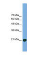 COMMD8 Antibody - COMMD8 antibody Western blot of Transfected 293T cell lysate. This image was taken for the unconjugated form of this product. Other forms have not been tested.