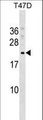 COMMD9 Antibody - COMMD9 Antibody western blot of T47D cell line lysates (35 ug/lane). The COMMD9 antibody detected the COMMD9 protein (arrow).