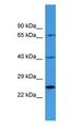 Complement C1R Antibody - Complement C1R antibody Western Blot of HeLa. Antibody dilution: 1 ug/ml.  This image was taken for the unconjugated form of this product. Other forms have not been tested.