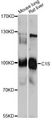 Complement C1s Antibody - Western blot analysis of extracts of various cell lines, using C1S antibody at 1:1000 dilution. The secondary antibody used was an HRP Goat Anti-Rabbit IgG (H+L) at 1:10000 dilution. Lysates were loaded 25ug per lane and 3% nonfat dry milk in TBST was used for blocking. An ECL Kit was used for detection and the exposure time was 90s.