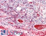 Complement C3 / C3b Antibody - Human Tonsil: Formalin-Fixed, Paraffin-Embedded (FFPE)
