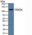 Complement C3a Antibody - Western Blot; Sample: Human Serum.
