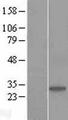 COMTD1 Protein - Western validation with an anti-DDK antibody * L: Control HEK293 lysate R: Over-expression lysate