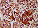 COPG2 Antibody - Immunohistochemistry image at a dilution of 1:400 and staining in paraffin-embedded human pancreatic tissue performed on a Leica BondTM system. After dewaxing and hydration, antigen retrieval was mediated by high pressure in a citrate buffer (pH 6.0) . Section was blocked with 10% normal goat serum 30min at RT. Then primary antibody (1% BSA) was incubated at 4 °C overnight. The primary is detected by a biotinylated secondary antibody and visualized using an HRP conjugated SP system.