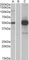 COPS3 / CSN3 Antibody - HEK293 lysate (10ug protein in RIPA buffer) overexpressing Human COPS3 with DYKDDDDK tag probed with (1.0ug/ml) in Lane A and probed with anti-DYKDDDDK Tag (1/5000) in lane C. Mock-transfected HEK293 probed (1mg/ml) in Lane B. Primary
