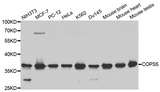 COPS5 / JAB1 Antibody - Western blot analysis of extracts of various cell lines, using COPS5 antibody at 1:1000 dilution. The secondary antibody used was an HRP Goat Anti-Rabbit IgG (H+L) at 1:10000 dilution. Lysates were loaded 25ug per lane and 3% nonfat dry milk in TBST was used for blocking.