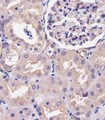COPS7B / CSN7B Antibody - COPS7B Antibody (N-Term) staining COPS7B in human kidney tissue sections by Immunohistochemistry (IHC-P - paraformaldehyde-fixed, paraffin-embedded sections). Tissue was fixed with formaldehyde and blocked with 3% BSA for 0. 5 hour at room temperature; antigen retrieval was by heat mediation with a citrate buffer (pH6). Samples were incubated with primary antibody (1/25) for 1 hours at 37°C. A undiluted biotinylated goat polyvalent antibody was used as the secondary antibody.