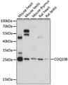 COQ10B Antibody - Western blot analysis of extracts of various cell lines, using COQ10B antibody at 1:1000 dilution. The secondary antibody used was an HRP Goat Anti-Rabbit IgG (H+L) at 1:10000 dilution. Lysates were loaded 25ug per lane and 3% nonfat dry milk in TBST was used for blocking. An ECL Kit was used for detection and the exposure time was 30s.
