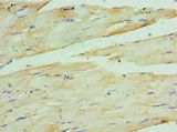 COQ7 Antibody - Immunohistochemistry of paraffin-embedded human skeletal muscle using antibody at 1:100 dilution.