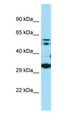COQ7 Antibody - COQ7 antibody Western Blot of MDA-MB-435S.  This image was taken for the unconjugated form of this product. Other forms have not been tested.
