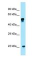 COQ7 Antibody - COQ7 antibody Western Blot of THP-1 cell lysate.  This image was taken for the unconjugated form of this product. Other forms have not been tested.
