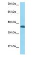 COQ9 Antibody - COQ9 antibody Western Blot of HCT15.  This image was taken for the unconjugated form of this product. Other forms have not been tested.