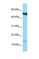 CORNIFIN / SPRR1B Antibody - SPRR1B antibody Western blot of Jurkat Cell lysate. Antibody concentration 1 ug/ml.  This image was taken for the unconjugated form of this product. Other forms have not been tested.