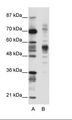 CORO1A / Coronin 1a Antibody - A: Marker, B: Jurkat Cell Lysate.  This image was taken for the unconjugated form of this product. Other forms have not been tested.