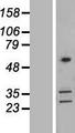 CORO2B Protein - Western validation with an anti-DDK antibody * L: Control HEK293 lysate R: Over-expression lysate