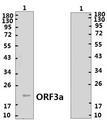 Coronavirus SARS-CoV-2 ORF3a Protein Protein