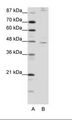 COUP-TFII / NR2F2 Antibody - A: Marker, B: HepG2 Cell Lysate.  This image was taken for the unconjugated form of this product. Other forms have not been tested.