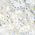COUP-TFII / NR2F2 Antibody - Immunohistochemical analysis of NR2F2 staining in human kidney formalin fixed paraffin embedded tissue section. The section was pre-treated using heat mediated antigen retrieval with sodium citrate buffer (pH 6.0). The section was then incubated with the antibody at room temperature and detected using an HRP conjugated compact polymer system. DAB was used as the chromogen. The section was then counterstained with hematoxylin and mounted with DPX.