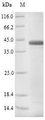 PAG1 / PSPB Protein - (Tris-Glycine gel) Discontinuous SDS-PAGE (reduced) with 5% enrichment gel and 15% separation gel.