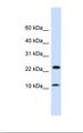 COX20 Antibody - Fetal muscle lysate. Antibody concentration: 1.0 ug/ml. Gel concentration: 10-20%.  This image was taken for the unconjugated form of this product. Other forms have not been tested.