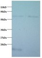 COX5B Antibody - Western blot of Cytochrome c oxidase subunit 5B, mitochondrial antibody at 2 ug/ml. Lane 1: EC109 whole cell lysate. Lane 2: 293T whole cell lysate. Secondary: Goat polyclonal to Rabbit IgG at 1:15000 dilution. Predicted band size: 14 kDa. Observed band size: 14 kDa Additional bands at: 65 kDa. We are unsure as to the identity of this extra band. This image was taken for the unconjugated form of this product. Other forms have not been tested.
