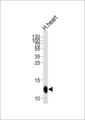 COX6A2 Antibody - Western blot of lysate from human heart tissue lysate, using COX6A2 Antibody. Antibody was diluted at 1:1000 at each lane. A goat anti-rabbit IgG H&L (HRP) at 1:5000 dilution was used as the secondary antibody. Lysate at 35ug per lane.