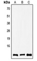COX8A Antibody - Western blot analysis of COX8A expression in A549 (A); SP2/0 (B); rat brain (C) whole cell lysates.